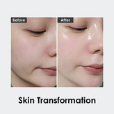 آمپول ضدچروک تخصصی Medipeel