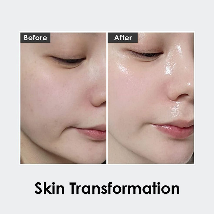 آمپول ضدچروک تخصصی Medipeel