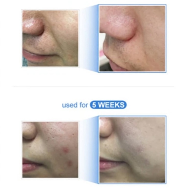 کرم کوچک کننده منافذ Medicube