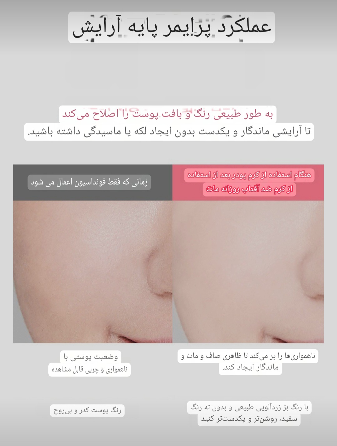 ضدآفتاب تن آپ Macqueen