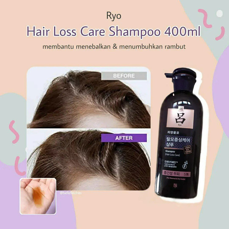 شامپو ضدریزش Ryo