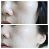 کرم ترمیم کننده ApomeDerm