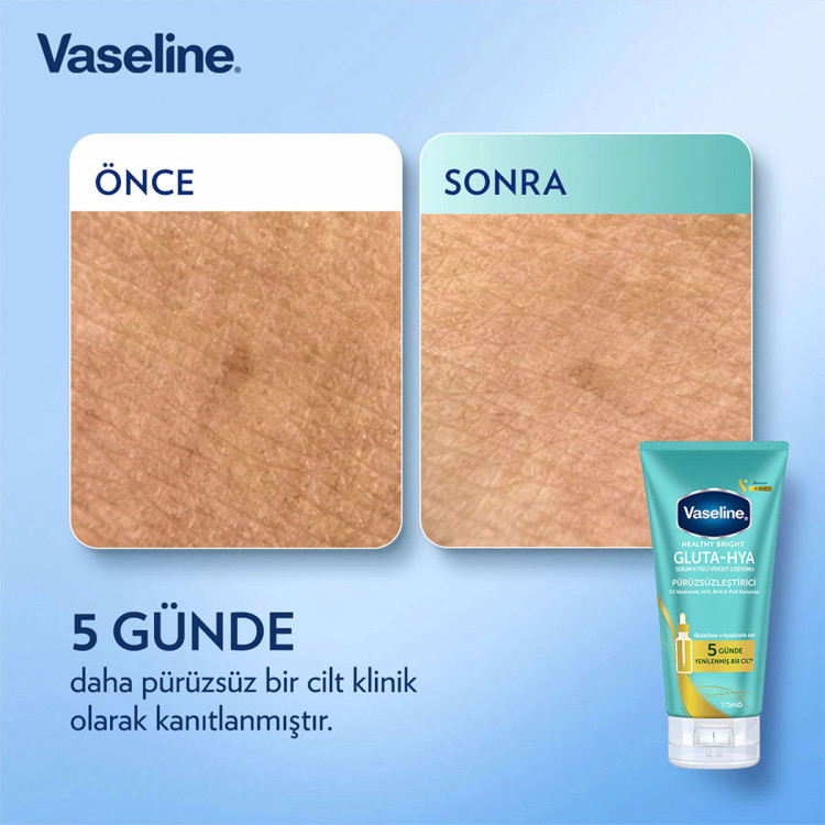 لوسیون بدن گلوتا-هیا ضدجوش و لک Vaseline